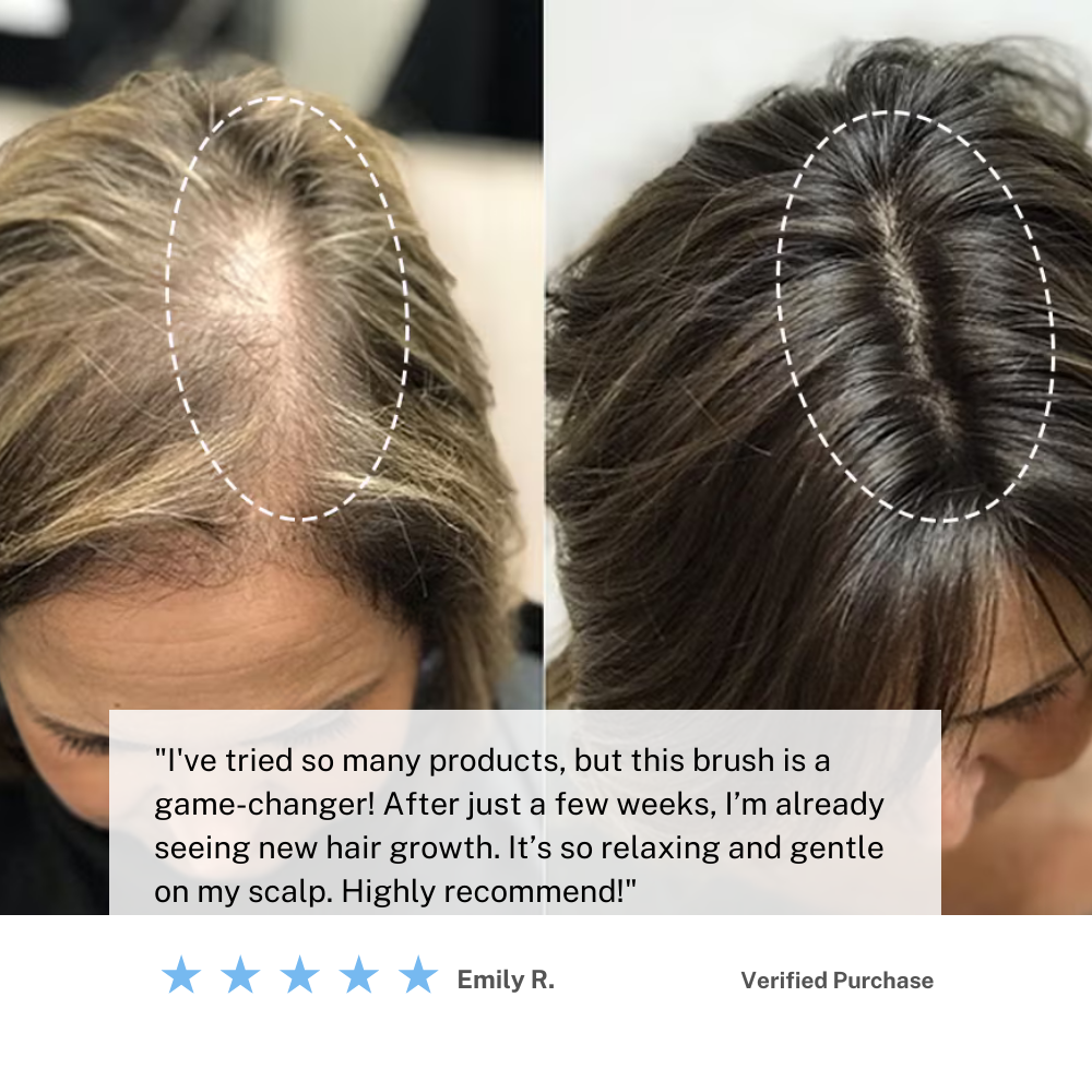 Mosrugs | Cordless Scalp Massaging Brush – Boost Hair Growth & Relax at Home