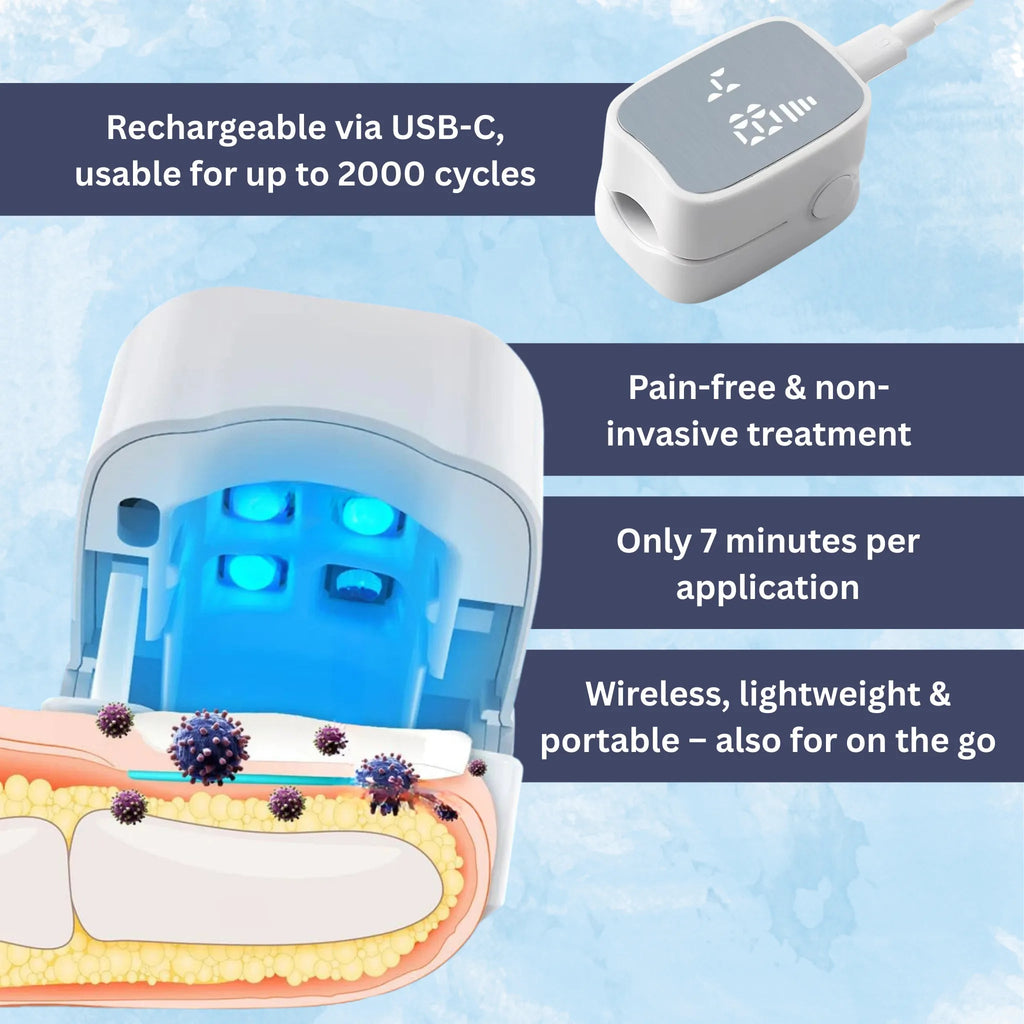 Mosrugs | Nail Fungus Laser Treatment Device | Effective, Portable & Ideal for Home Use