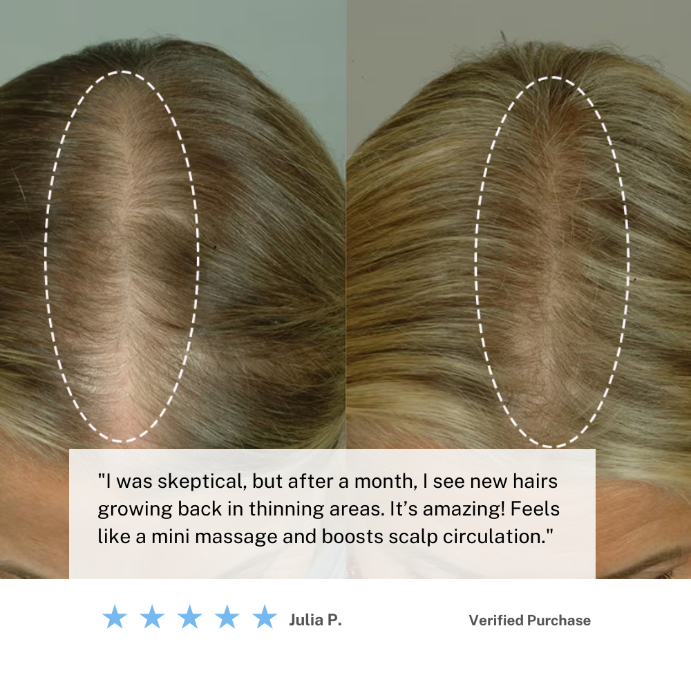 Mosrugs | Cordless Scalp Massaging Brush – Boost Hair Growth & Relax at Home