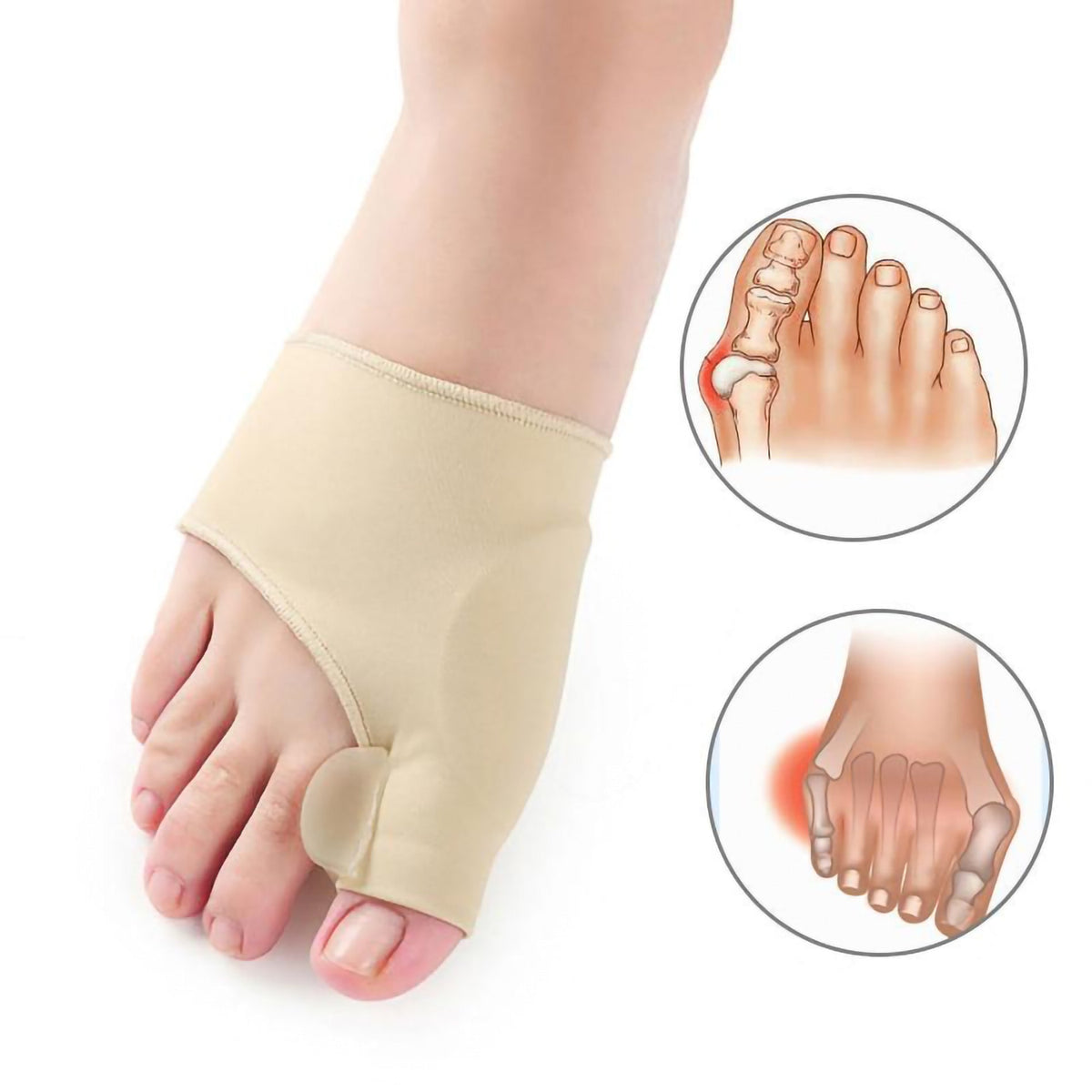 Mosrugs | Oraliu Bunion Orthopedic Corrector Sleeve