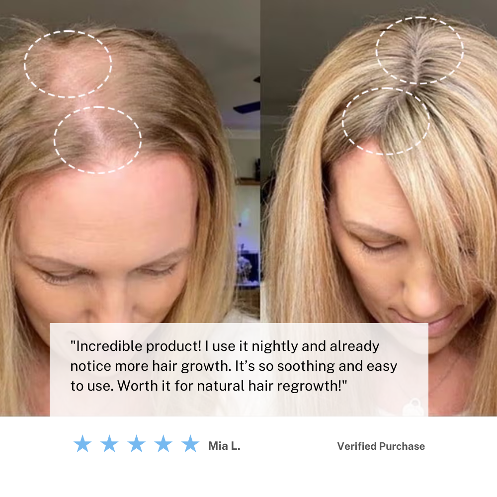 Mosrugs | Cordless Scalp Massaging Brush – Boost Hair Growth & Relax at Home