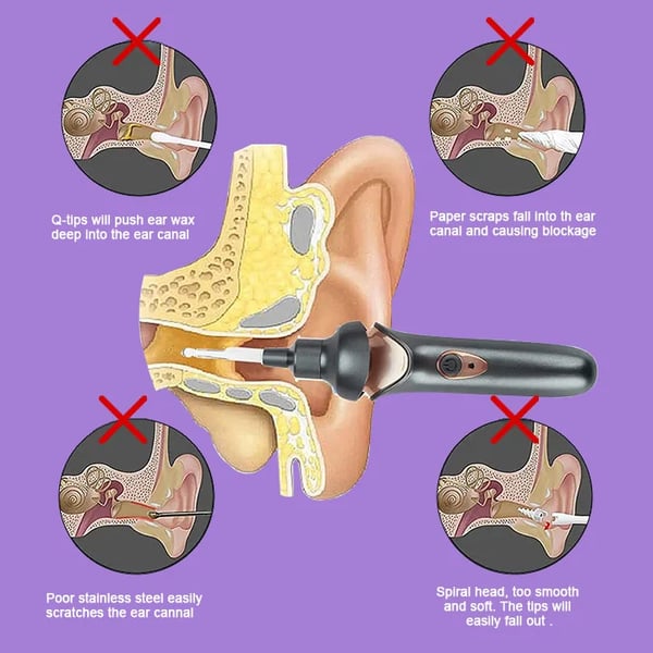 Mosrugs | Painless Ear Wax Removal Kit – Safe & Effective Cleaning for the Whole Family