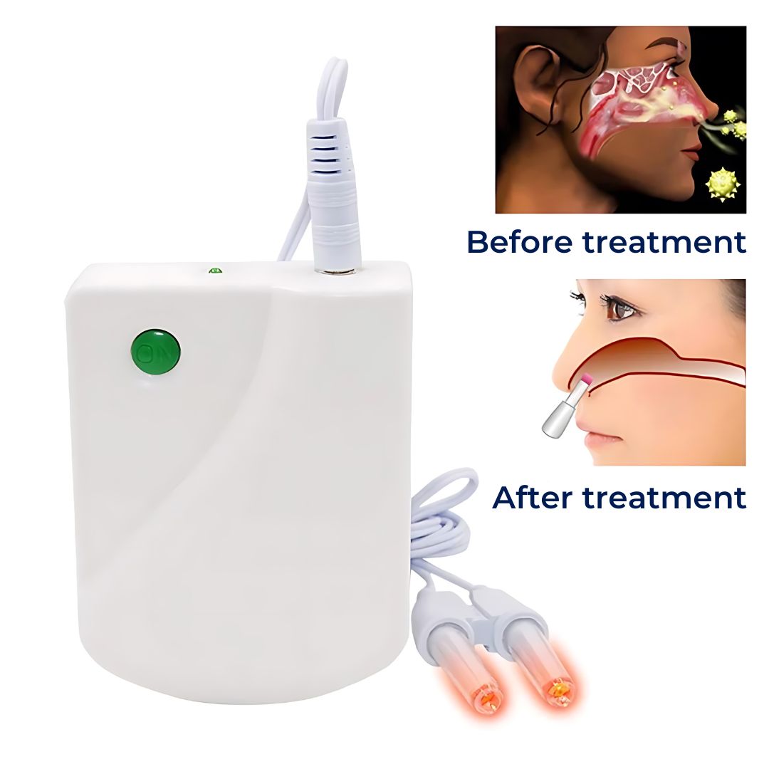 Mosrugs | Infrared Therapy Device for Allergic Rhinitis and Runny Nose Relief, Comfortable Nasal Congestion Treatment
