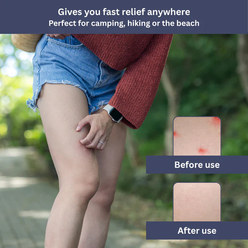 Mosrugs | InstaRelief Sting Healer | Fast-Acting, Natural Formula for Insect Bites & Skin Irritations