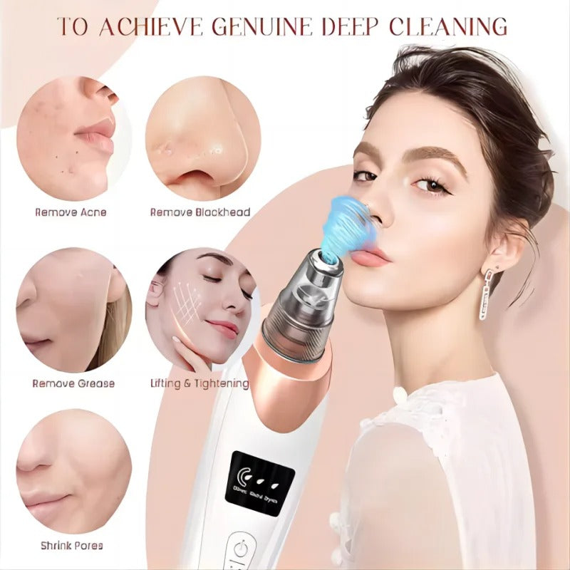 Mosrugs | Blackhead Remover Vacuum Pore Cleaner | Adjustable Suction, Multi-Functional Tool for Deep Cleansing & Acne Treatment at Home