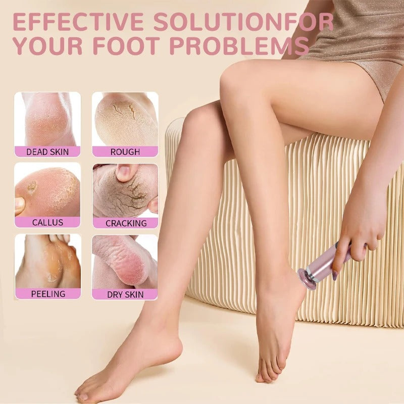 Mosrugs | 2-in-1 Electric Foot & Hand Care Tool | Callus Remover & Nail Polisher for At-Home Pedicures