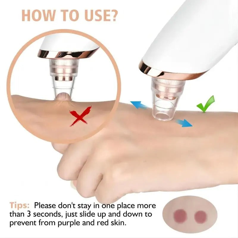 Mosrugs | Blackhead Remover Vacuum Pore Cleaner | Adjustable Suction, Multi-Functional Tool for Deep Cleansing & Acne Treatment at Home