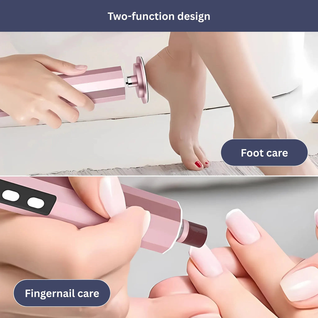 Mosrugs | Electric Callus Remover | Rechargeable, Waterproof & Ideal for Smooth Feet at Home